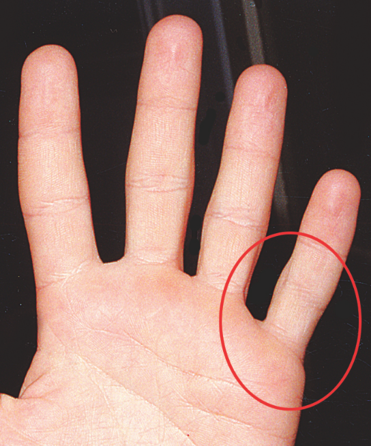 אוראלי שלילי